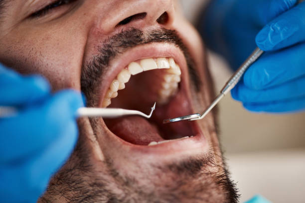 Best Pediatric Emergency Dentist in Vincent, AL